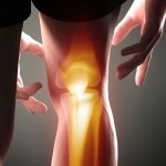 13 moduri de tratament național de osteoartrita a genunchiului