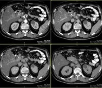 RMN a abdomenului - prețurile de la Moscova au găsit 86 preturi (cavitatea) RMN a abdomenului - prețurile de la Moscova au găsit 86 prețuri