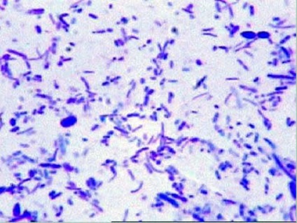 Este dificil pentru tratarea infecțiilor - Pseudomonas aeruginosa, creștem subțire