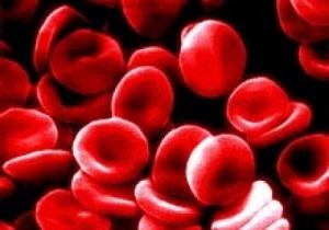 Anemia 1 grad (grad) Anemia 1 grad