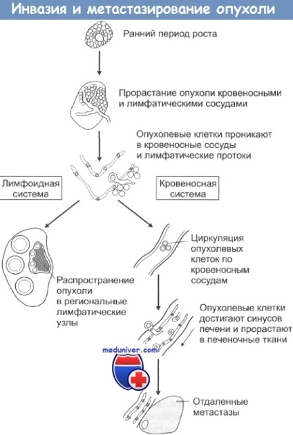 angiogeneza tumorală (creșterea vaselor sanguine) angiogeneza tumorală