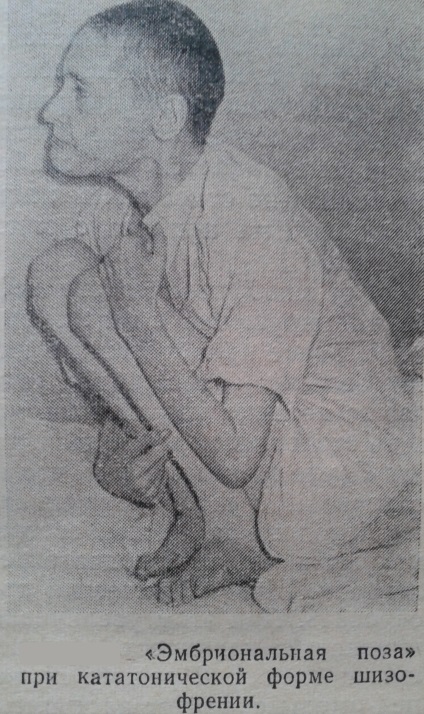 Ce este schizofrenia este o tulburare psihotică (tulburare) Ce este schizofrenia este o tulburare psihotică