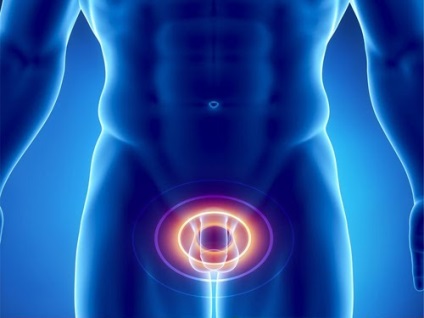 Hernia testiculului la bărbați (hernie) Hernia testiculului la bărbați
