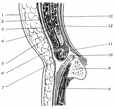 Herniile fascia transversal (transversal) Hernii fascia transversal