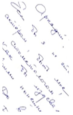 Îndepărtarea corp străin din canalul dintelui (canalului radicular) și provoacă lovirea metode (canal) Eliminarea corpului străin din canalul dintelui (canalului radicular) determină pătrunderea și metode