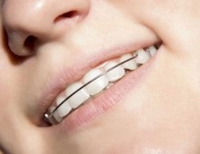 acolade combinate - metoda de corecție eficientă și de a salva (combinate) acolade combinate - corecția efectivă și o modalitate de a salva