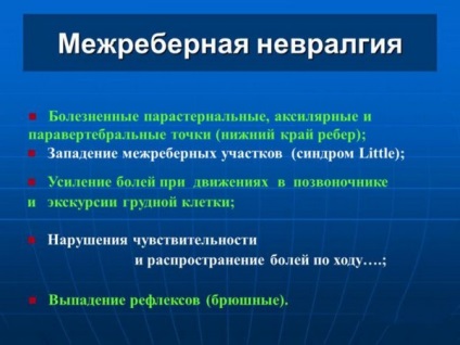 simptomele și tratamentul intercostale nevralgii, cauza a (tratament) simptome și tratament intercostală nevralgii, cauzele