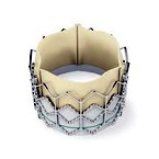 Operațiunea Rossa - înlocuirea valvei aortice (ventilul) Operațiunea Rossa - înlocuirea valvei aortice