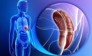 ruptură splenică (purificarea sângelui) ruptură splenică