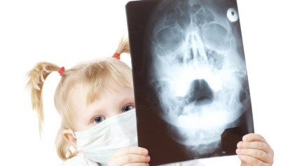 Razele X ale sinusurilor nazale în cazul în care și cât de des se poate face, descifrarea (a face) Razele X ale sinusurilor nazale în cazul în care și cât de des puteți face, descifrarea