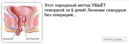 hemoroizi recăderi (hemoroizi) Reapariția hemoroizi