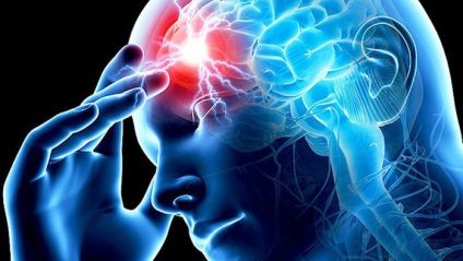 Tipuri de accident vascular cerebral (accident vascular cerebral, moartea celulelor se produce) tipuri de accident vascular cerebral