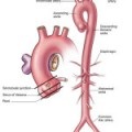 Tipuri de vindecare a rănilor - Medical Journal