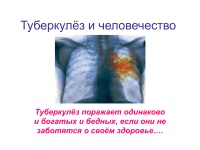 996 Prezentări privind tuberculoza la (tuberculoza) 996 Prezentări privind tuberculoza la