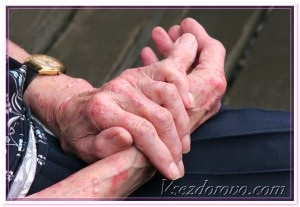 Alergia la cosmetice (sensibil) Alergia la cosmetice