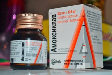 Angina în timpul sarcinii (dureri în gât la femeile gravide) Angina în timpul sarcinii