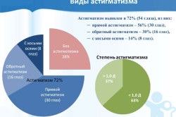 Astigmatismul si miopie (caracteristica astigmatism miopic) Astigmatismul și miopiei