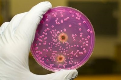 candidoză bacteriană (afte) și vaginita cauze, prevenire si tratament (vaginita) candidoză bacteriană (afte) și vaginita cauzele, prevenirea și tratamentul