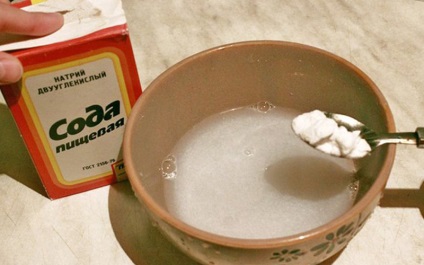 Cauzele candidoză bacteriene, tratamentul, prevenirea (bacteriene) Cauzele candidoză bacteriene, tratamentul, prevenirea