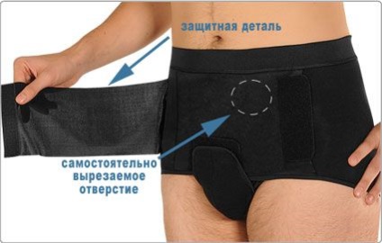 dimensiunea postoperatorie Bandaj, selecție, preț (opțional) Bandaj postoperatorie dimensiune, selectie, pret
