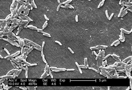 Campylobacter (Campylobacter) (Text Campylobacter) Campylobacter (Campylobacter)