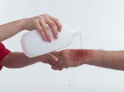 Ce se întâmplă dacă ard (fac) Ce se întâmplă dacă am arde