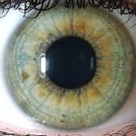 Diagnosticul de boli ale irisului ochiului - medicul dumneavoastră Aibolit (organism) Diagnosticul de boli ale irisului ochiului - medicul dumneavoastră Aibolit