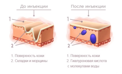 ginecologie estetică 1 (estetică) Estetica Ginecologie 1
