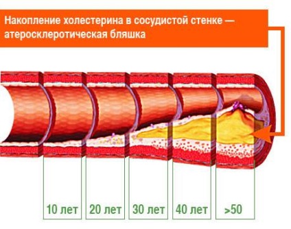 De sănătate a sistemului cardiovascular (igiena) Sănătatea sistemului cardiovascular