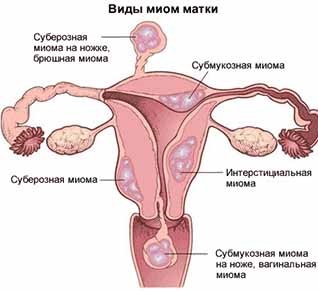 Ginecologie la Moscova, ieftin, sfaturi în jurul valorii de ceas (dureri pelviene) Ginecologie la Moscova, ieftin, sfaturi în jurul valorii de ceas