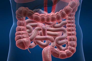 Studiile arata ca pacientii tineri au un risc mai mare de a dezvolta colorectal (pacienți) Studiile arata ca pacientii tineri au un risc mai mare de a dezvolta colorectal