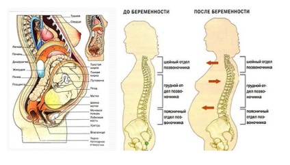 Yoga in hernie spinal (formarea postura) Yoga în hernie spinării