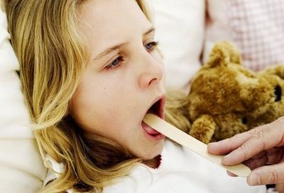 Cât timp este angina infecțioasă cu tratamentul cu antibiotice, antibiotice pentru dureri de gât (tratament) Cât timp este angina infecțioasă cu tratamentul cu antibiotice, antibiotice pentru dureri în gât