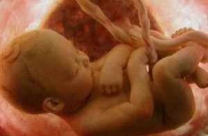 Cum de a calma copilul în abdomen, o revistă pentru femei despre relații, frumusețe, sănătate, familie, fitness (abdominale) Cum de a calma copilul în abdomen, o revistă pentru femei despre relații, frumusețe, sănătate, familie, fitness