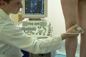chisturi Baker ale etiopatogenia genunchiului, diagnostic și tratament (tratament) chisturi de etiopatogenia genunchiului, diagnostic si tratament Baker