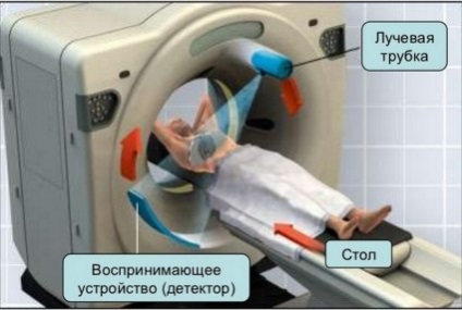 Tomografia computerizată a coloanei vertebrale și cât de important avantajele sale