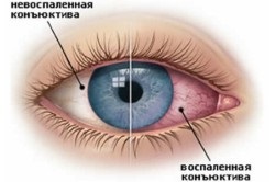 Brown la fața locului în ochi (ochi) dot Brown în ochi