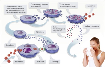 Tratamentul alergiilor homeopatiei (homeopatie tratament este alergie) Allergy Tratamentul Homeopatia