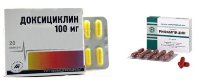 Tratamentul și prevenirea tularemie (tratament) Tratamentul și prevenirea tularemie
