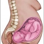 Tratamentul djufaston ovarelor polichistice (polichistic ovarian Djufaston) Tratamentul djufaston ovarelor polichistice