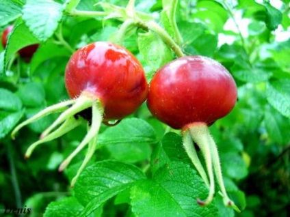 Limfosan Arthro, sibzdor (sibzdor) Arthro Limfosan, sibzdor