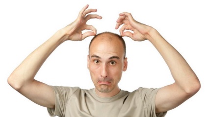 Unguent de alopecie, o revizuire a creme si balsamuri cu alopecie (scalpului) Unguent de alopecie, o revizuire a creme si balsamuri cu alopecie