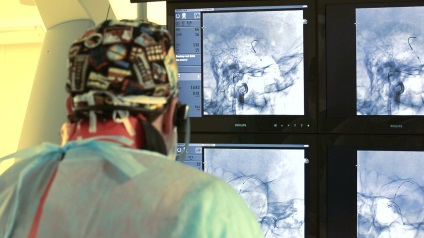 Tratamentul microchirurgical al bolilor cerebrovasculare (sub anestezie generală) Tratamentul microchirurgical al bolilor cerebrovasculare