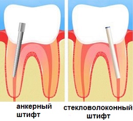 Este posibil pentru a restabili dintii grav deteriorate (distruse) Este posibil pentru a restabili dintii grav afectate