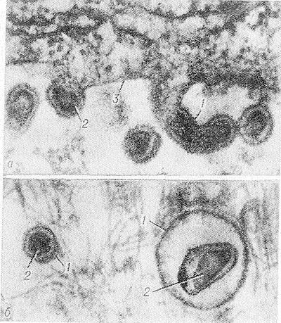 virusurile oncogene (oncovirus oncovirus tip) virus oncogen