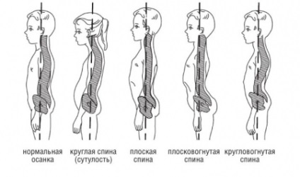 Ortopedie - coloanei vertebrale (echoencephalography) Ortopedie - coloanei vertebrale