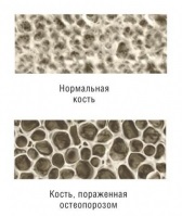 Ortopedie - coloanei vertebrale (echoencephalography) Ortopedie - coloanei vertebrale
