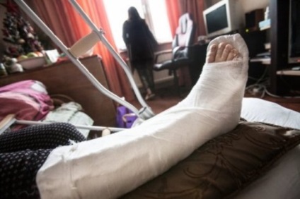 Fractura exterior glezna (glezna comune) Fractura glezna exterior