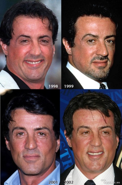 Plastic Sylvester Stallone (Stallone) Plastic Sylvester Stallone