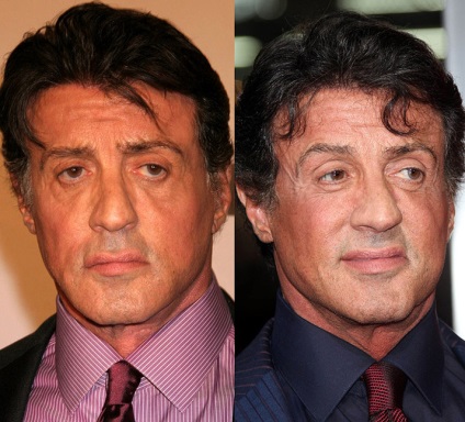 Plastic Sylvester Stallone (Sylvester Stallone creștere în greutate) Plastic Sylvester Stallone